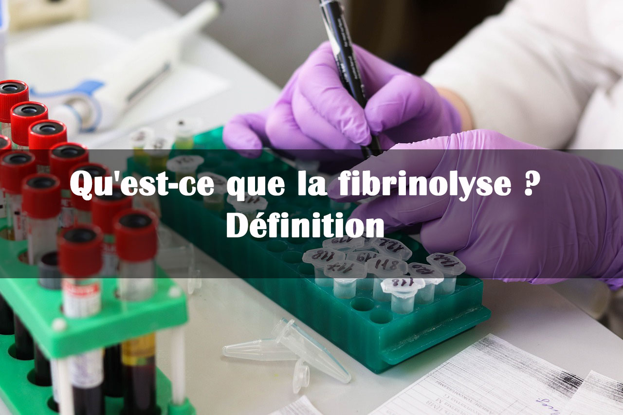 fibrinolyse definition